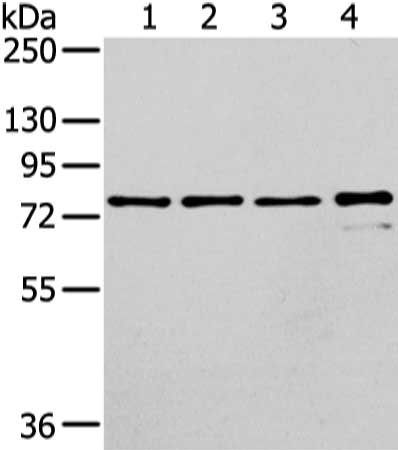 Gel: 6%SDS-PAGE, Lysate: 40 ug, Lane 1-4: Raji, K562, skov3 and pc3 cell, Primary antibody: CSB-PA381442(GHR Antibody) at dilution 1/400 dilution, Secondary antibody: Goat anti rabbit IgG at 1/8000 dilution, Exposure time: 30 seconds
