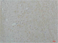 Immunohistochemical analysis of paraffin-embedded Rat Brain Tissue using Cav2.2Rabbit pAb diluted at 1:200.
