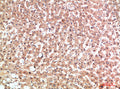 Immunohistochemical analysis of paraffin-embedded human-liver, antibody was diluted at 1:200