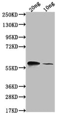 Western Blot
Positive WB detected in Recombinant protein
All lanes: omp38 antibody at 1:2000
Secondary
Goat polyclonal to rabbit IgG at 1/50000 dilution
Predicted band size: 52.5 kDa
Observed band size: 66 kDa