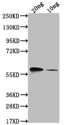 Western Blot
Positive WB detected in Recombinant protein
All lanes: omp38 antibody at 1:2000
Secondary
Goat polyclonal to rabbit IgG at 1/50000 dilution
Predicted band size: 52.5 kDa
Observed band size: 66 kDa