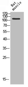 PARP1 Antibody – Figure 1 of 1