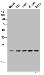 Western blot analysis of HepG2 823-AV 293T AD293 Hela lysis using PGLYRP1 antibody. Antibody was diluted at 1:1000. Secondary antibody  was diluted at 1:20000