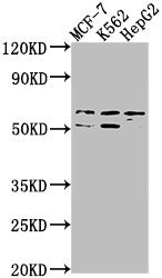 Western Blot
Positive WB detected in: MCF-7 whole cell lysate, K562 whole cell lysate, HepG2 whole cell lysate
All lanes: USP17L3 antibody at 1:1000
Secondary
Goat polyclonal to rabbit IgG at 1/50000 dilution
Predicted band size: 60 kDa
Observed band size: 60 kDa