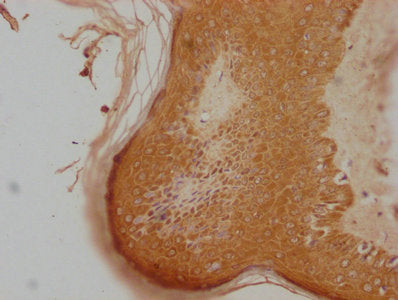 IHC image of CSB-PA408988LA01HU diluted at 1:100 and staining in paraffin-embedded human skin tissue performed on a Leica BondTM system. After dewaxing and hydration, antigen retrieval was mediated by high pressure in a citrate buffer (pH 6.0). Section was blocked with 10% normal goat serum 30min at RT. Then primary antibody (1% BSA) was incubated at 4°C overnight. The primary is detected by a biotinylated secondary antibody and visualized using an HRP conjugated SP system.