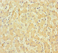 Immunohistochemistry of paraffin-embedded human liver tissue using CSB-PA409861LA01HU at dilution of 1:100