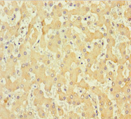 Immunohistochemistry of paraffin-embedded human liver tissue using CSB-PA409861LA01HU at dilution of 1:100