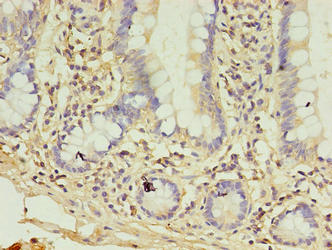 Immunohistochemistry of paraffin-embedded human small intestine tissue using CSB-PA409861YA01HU at dilution of 1:100