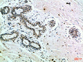 INSR Antibody – Figure 1 of 1