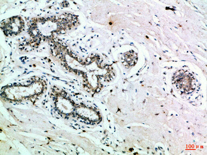 INSR Antibody – Figure 1 of 1