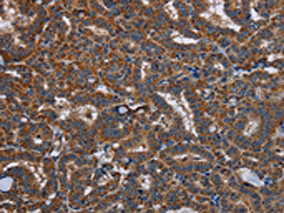 LYN Antibody – Figure 1 of 2