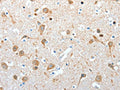 The image on the left is immunohistochemistry of paraffin-embedded Human brain tissue using CSB-PA425535(AKAP4 Antibody) at dilution 1/10, on the right is treated with fusion protein. (Original magnification: ×200)