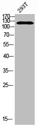 Western blot analysis of 293T using Acetyl-RIP140 (K158) antibody. Antibody was diluted at 1:500. Secondary antibody  was diluted at 1:20000