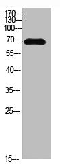 Western blot analysis of MCF7 SW480 MOUSE-LIVER mouse-lung MOUSE-KIDNEY lysate, antibody was diluted at 500. Secondary antibody  was diluted at 1:20000
