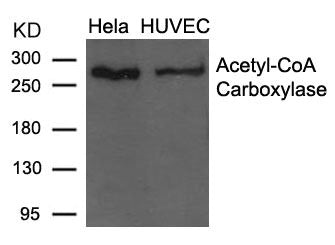 Western blot analysis of extracts from Hela and HUVEC cells using Acetyl-CoA Carboxylase (Ab-79)  Antibody.