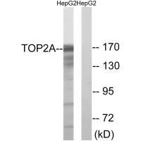 Western blot analysis of extracts from HepG2 cells, using TOP2A (Ab-1343) antibody.