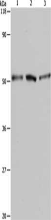 Gel: 10%SDS-PAGE, Lysate: 40 ug, Lane 1-3: A549 cells, Hela cells, 293T cells, Primary antibody: CSB-PA438344(BAG5 Antibody) at dilution 1/500, Secondary antibody: Goat anti rabbit IgG at 1/8000 dilution, Exposure time: 1 minute