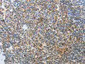 The image on the left is immunohistochemistry of paraffin-embedded Human tonsil tissue using CSB-PA438371(AD7C-NTP Antibody) at dilution 1/25, on the right is treated with synthetic peptide. (Original magnification: ×200)