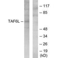 Western blot analysis of extracts from 293 cells, using TAF6L antibody.