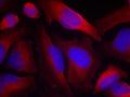 Immunofluorescence staining of methanol-fixed Hela cells using Tyrosine Hydroxylase(Phospho-Ser19) Antibody.
