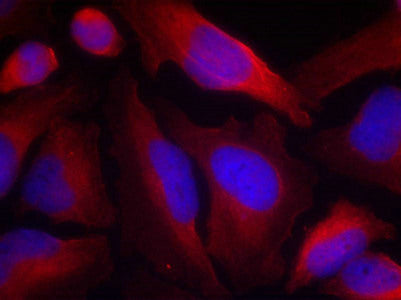 Immunofluorescence staining of methanol-fixed Hela cells using Tyrosine Hydroxylase(Phospho-Ser19) Antibody.