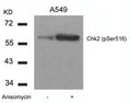 Western blot analysis of extracts from A549 cells untreated or treated with Anisomycin using Chk2(Phospho-Ser516) Antibody.