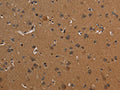The image on the left is immunohistochemistry of paraffin-embedded Human brain tissue using CSB-PA440434(ICAM4 Antibody) at dilution 1/30, on the right is treated with fusion protein. (Original magnification: ×200)
