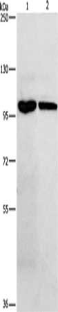 Gel: 8%SDS-PAGE, Lysate: 40 ug, Lane 1-2: Hela cells, 231 cells, Primary antibody: CSB-PA441503(NFKB1 Antibody) at dilution 1/250, Secondary antibody: Goat anti rabbit IgG at 1/8000 dilution, Exposure time: 1 minute