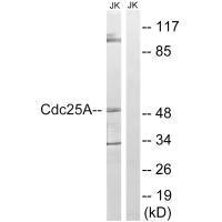 Western blot analysis of extracts from Jurkat cells, using CDC25A (Ab-178) antibody.