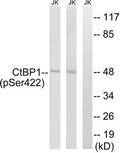 Western blot analysis of extracts from Jurkat cells treated with TNF using CtBP1 (Phospho-Ser422) Antibody.The lane on the right is treated with the antigen-specific peptide.