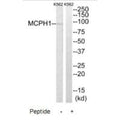 Western blot analysis of extracts from K562 cells, using MCPH1 antibody.