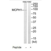 Western blot analysis of extracts from K562 cells, using MCPH1 antibody.