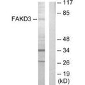 Western blot analysis of extracts from HepG2 cells, using FAKD3 antibody.