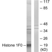 Western blot analysis of extracts from A549 cells, using Histone 1F0 antibody.