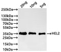 Western Blot
Positive WB detected in: recombinant protein
All lanes:HEL2 Antibody at 1:1000
Secondary
Goat polyclonal to rabbit IgG at 1/20000 dilution
Predicted band size: 34.4 kDa
Observed band size: 35 kDa