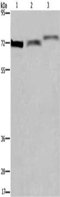 Gel: 6%SDS-PAGE, Lysate: 40 ug, Lane 1-3: Hela cells, mouse heart tissue, Mouse stomach tissue, Primary antibody: CSB-PA445707(ARNTL Antibody) at dilution 1/300, Secondary antibody: Goat anti rabbit IgG at 1/8000 dilution, Exposure time: 1 minute