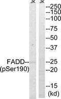 Western blot analysis of extracts from Jurkat cells treated with PMA using FADD (Phospho-Ser190) Antibody.The lane on the right is treated with the antigen-specific peptide.