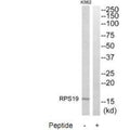 Western blot analysis of extracts from K562 cells, using RPS19 antibody.