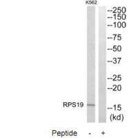 Western blot analysis of extracts from K562 cells, using RPS19 antibody.