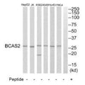 Western blot analysis of extracts from HeLa cells, HepG2 cells, Huvec cells, A549 cells, K562 cells and Jurkat cells, using BCAS2 antibody.