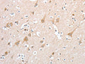 The image on the left is immunohistochemistry of paraffin-embedded Human brain tissue using CSB-PA447170(PCDHB16 Antibody) at dilution 1/30, on the right is treated with fusion protein. (Original magnification: ×200)