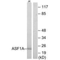 Western blot analysis of extracts from Jurkat cells, using ASF1A antibody.