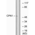Western blot analysis of extracts from RAW264.7 cells, using CPN1 antibody.