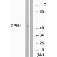Western blot analysis of extracts from RAW264.7 cells, using CPN1 antibody.
