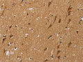 The image on the left is immunohistochemistry of paraffin-embedded Human brain tissue using CSB-PA448660(NDUFS5 Antibody) at dilution 1/20, on the right is treated with fusion protein. (Original magnification: ×200)