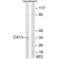 Western blot analysis of extracts from HepG2 cells, using CA13 antibody.