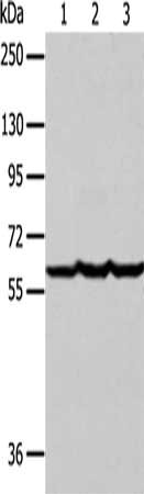 Gel: 8%SDS-PAGE, Lysate: 40 ug, Lane 1-3: Human liver cancer tissue, hela cells, Jurkat cells, Primary antibody: CSB-PA448903(F9 Antibody) at dilution 1/400, Secondary antibody: Goat anti rabbit IgG at 1/8000 dilution, Exposure time: 30 seconds