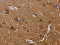 The image on the left is immunohistochemistry of paraffin-embedded Human brain tissue using CSB-PA448974(FGFR1OP Antibody) at dilution 1/40, on the right is treated with fusion protein. (Original magnification: ×200)