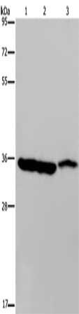 Gel: 8%SDS-PAGE, Lysate: 40 ug, Lane 1-3: Mouse heart tissue, Mouse liver tissue, Mouse stomach tissue, Primary antibody: CSB-PA449427(MDH1 Antibody) at dilution 1/500, Secondary antibody: Goat anti rabbit IgG at 1/8000 dilution, Exposure time: 3 seconds
