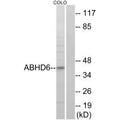 Western blot analysis of extracts from COLO cells, using ABHD6 antibody.